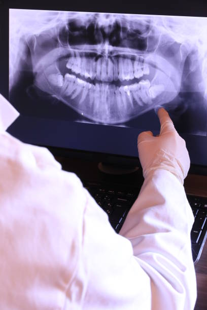 Best Emergency Tooth Extraction in Herculaneum, MO